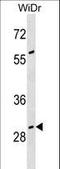 Growth Arrest Specific 2 antibody, LS-C159709, Lifespan Biosciences, Western Blot image 