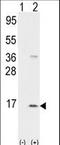 Pro-Platelet Basic Protein antibody, LS-C163894, Lifespan Biosciences, Western Blot image 