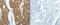 Rho Associated Coiled-Coil Containing Protein Kinase 1 antibody, TA322615, Origene, Immunohistochemistry frozen image 