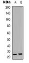 Syndecan 4 antibody, orb318923, Biorbyt, Western Blot image 