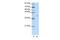 Eukaryotic Translation Initiation Factor 3 Subunit G antibody, GTX47376, GeneTex, Western Blot image 