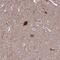 Centrosomal Protein 41 antibody, NBP1-92538, Novus Biologicals, Immunohistochemistry frozen image 