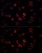 Serum/Glucocorticoid Regulated Kinase 1 antibody, GTX54726, GeneTex, Immunofluorescence image 