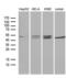 Ribonucleotide Reductase Regulatory Subunit M2 antibody, LS-C792500, Lifespan Biosciences, Western Blot image 