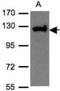 Unc-13 Homolog D antibody, NBP1-31072, Novus Biologicals, Western Blot image 