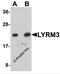 NADH:Ubiquinone Oxidoreductase Subunit B9 antibody, 5663, ProSci, Western Blot image 