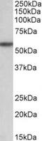 Transforming Growth Factor Beta Receptor 1 antibody, TA311306, Origene, Western Blot image 