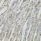 Adaptor Related Protein Complex 2 Subunit Beta 1 antibody, GTX32450, GeneTex, Immunohistochemistry paraffin image 
