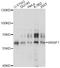 WASP Family Member 1 antibody, LS-C749618, Lifespan Biosciences, Western Blot image 