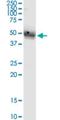 ST8 Alpha-N-Acetyl-Neuraminide Alpha-2,8-Sialyltransferase 4 antibody, H00007903-M03, Novus Biologicals, Western Blot image 