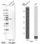 RANBP2-Type And C3HC4-Type Zinc Finger Containing 1 antibody, NBP1-88301, Novus Biologicals, Western Blot image 