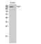 Desmoglein 2 antibody, STJ92783, St John
