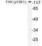 Protein Tyrosine Kinase 2 antibody, LS-C177999, Lifespan Biosciences, Western Blot image 
