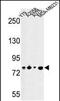 Lysine Acetyltransferase 14 antibody, PA5-49650, Invitrogen Antibodies, Western Blot image 