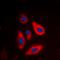 TSC Complex Subunit 2 antibody, orb224038, Biorbyt, Immunofluorescence image 