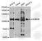 Lysine Demethylase 4B antibody, A5824, ABclonal Technology, Western Blot image 