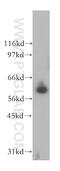 PPIase antibody, 12590-2-AP, Proteintech Group, Western Blot image 