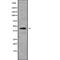 Potassium Voltage-Gated Channel Subfamily J Member 10 antibody, abx216384, Abbexa, Western Blot image 