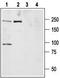 Sodium Voltage-Gated Channel Alpha Subunit 9 antibody, TA329033, Origene, Western Blot image 