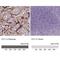 Fms Related Tyrosine Kinase 1 antibody, NBP2-52919, Novus Biologicals, Immunohistochemistry paraffin image 