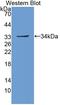 Glycoprotein Ib Platelet Subunit Alpha antibody, LS-B15258, Lifespan Biosciences, Western Blot image 