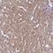 Reticulocalbin 3 antibody, NBP2-13213, Novus Biologicals, Immunohistochemistry paraffin image 