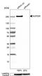 Nucleoporin 205 antibody, HPA024574, Atlas Antibodies, Western Blot image 