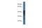 Gamma-Aminobutyric Acid Type A Receptor Beta1 Subunit antibody, PA5-40342, Invitrogen Antibodies, Western Blot image 