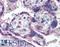 Tumor Protein P73 antibody, LS-B2085, Lifespan Biosciences, Immunohistochemistry paraffin image 
