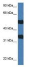 Arylsulfatase G antibody, NBP1-79576, Novus Biologicals, Western Blot image 