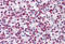 DNA Topoisomerase II Alpha antibody, MBS245817, MyBioSource, Immunohistochemistry frozen image 