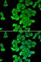 SET And MYND Domain Containing 2 antibody, LS-C334744, Lifespan Biosciences, Immunofluorescence image 