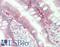 Galectin 3 antibody, LS-C7048, Lifespan Biosciences, Immunohistochemistry frozen image 