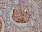 Complement C3b/C4b Receptor 1 (Knops Blood Group) antibody, CSB-RA714310A0HU, Cusabio, Immunohistochemistry paraffin image 