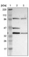 DSN1 Component Of MIS12 Kinetochore Complex antibody, NBP1-88302, Novus Biologicals, Western Blot image 