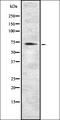 Growth Differentiation Factor 15 antibody, orb337473, Biorbyt, Western Blot image 