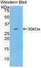 Mitogen-Activated Protein Kinase Kinase Kinase Kinase 5 antibody, LS-C295393, Lifespan Biosciences, Western Blot image 