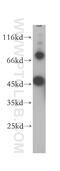 Carbohydrate Sulfotransferase 14 antibody, 17749-1-AP, Proteintech Group, Western Blot image 
