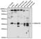 Rab Geranylgeranyltransferase Subunit Beta antibody, A15310, ABclonal Technology, Western Blot image 