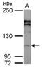 Adaptor Related Protein Complex 2 Subunit Alpha 2 antibody, NBP2-15417, Novus Biologicals, Western Blot image 