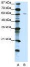 Zinc Finger Protein 286A antibody, TA345290, Origene, Western Blot image 