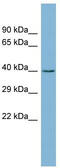 Zinc Finger CCHC-Type Containing 12 antibody, TA337770, Origene, Western Blot image 