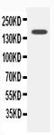 CF Transmembrane Conductance Regulator antibody, PA2201, Boster Biological Technology, Western Blot image 