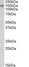 Kalirin RhoGEF Kinase antibody, NB100-41371, Novus Biologicals, Western Blot image 