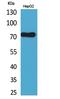 Lymphocyte Antigen 9 antibody, A05830, Boster Biological Technology, Western Blot image 