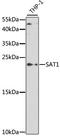 Spermidine/Spermine N1-Acetyltransferase 1 antibody, STJ26208, St John