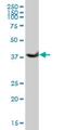 Alcohol Dehydrogenase 1B (Class I), Beta Polypeptide antibody, H00000125-B01P, Novus Biologicals, Western Blot image 