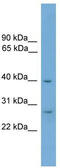 ATP Synthase Mitochondrial F1 Complex Assembly Factor 1 antibody, TA344672, Origene, Western Blot image 