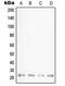 Peptidylprolyl Isomerase F antibody, MBS820715, MyBioSource, Western Blot image 