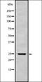 Cytokine Receptor Like Factor 3 antibody, orb337727, Biorbyt, Western Blot image 